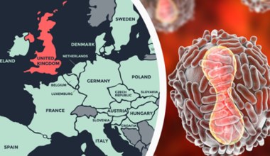 Małpia ospa w Wielkiej Brytanii. Wszystko na temat choroby