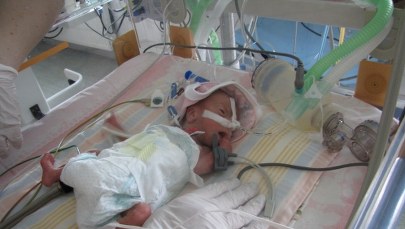 Malutki Mateusz, który waży zaledwie 800 gramów 