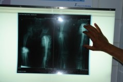 Mały Ruben wciąż nie wie, że jego rodzice zginęli w katastrofie