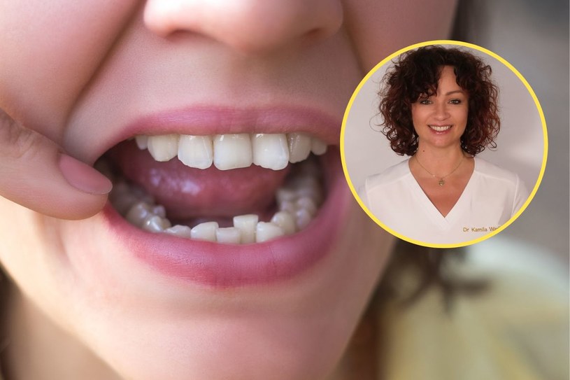Mama Ortodonta - lek. stom. Kamila Wasiluk - przestrzega, by nie prostować zębów na własną rękę. Może to niszczyć zęby, wywoływać bóle głowy i bezsenność /fot. mat. prasowe /123RF/PICSEL