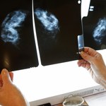 Mammografia nie pomaga w walce z rakiem? 