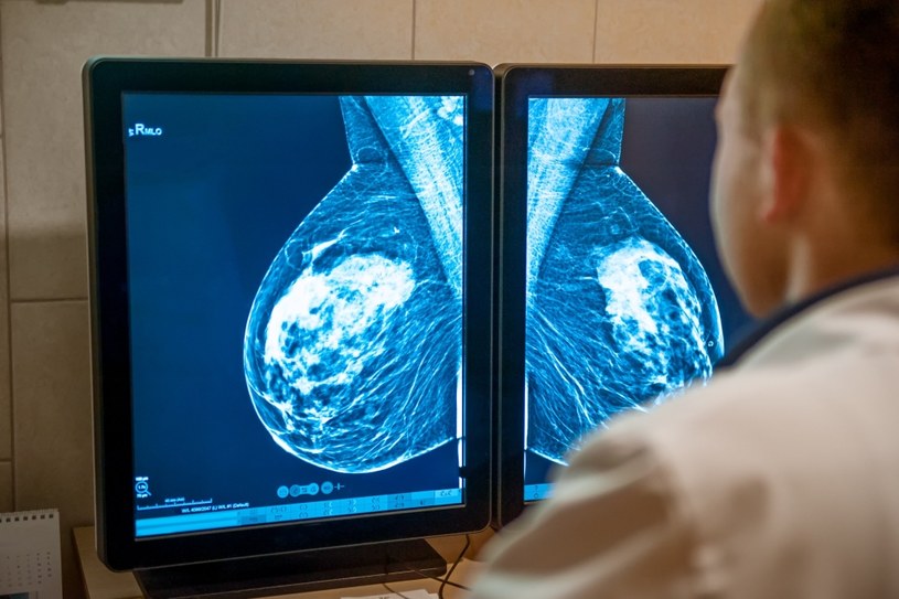 Mammografia to badanie, które pozwala wykryć nowotwór piersi oraz wdrożyć odpowiednie leczenie /123RF/PICSEL