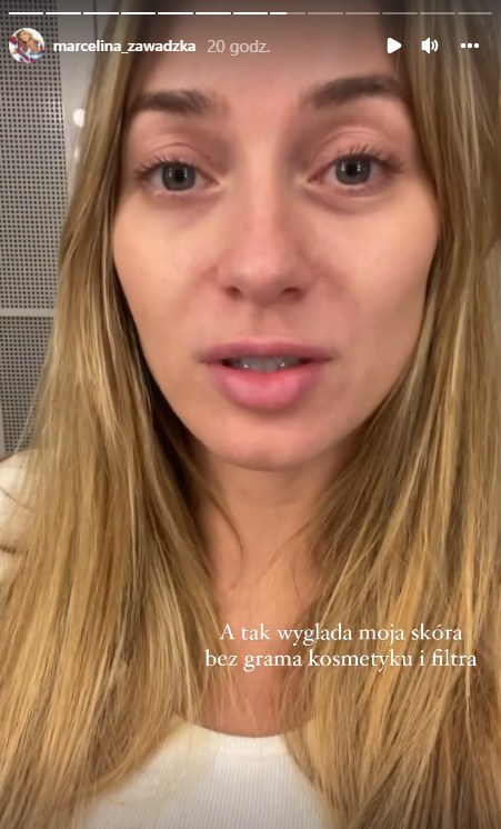 Marcelina Zawadzka bez makijażu https://www.instagram.com/marcelina_zawadzka/ /Instagram
