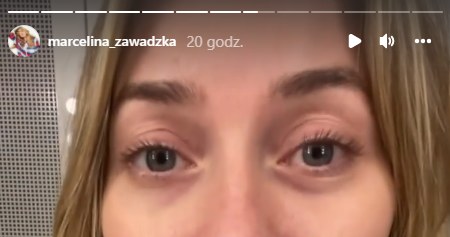 Marcelina Zawadzka bez makijażu https://www.instagram.com/marcelina_zawadzka/ /Instagram