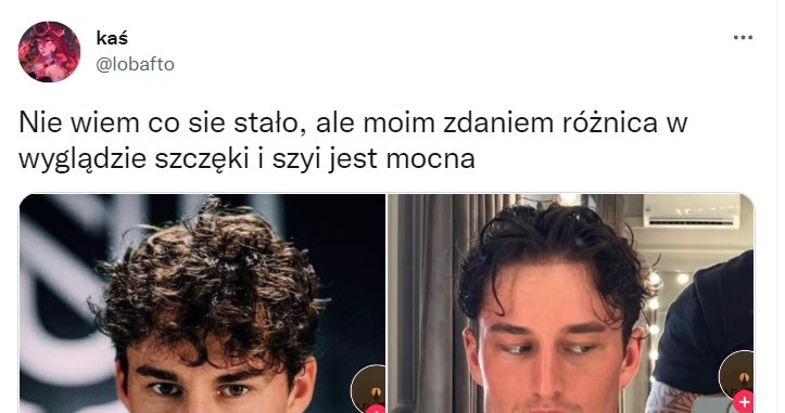 Marcin Dubiel i jego zmieniona szczęka /Twitter