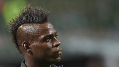 Mario Balotelli po operacji. Przez miesiąc nie wyjdzie na murawę