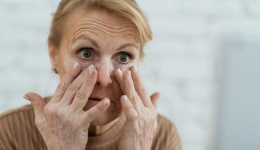 Maść arnikowa pod oczy. Nietypowy składnik na sińce pod oczami