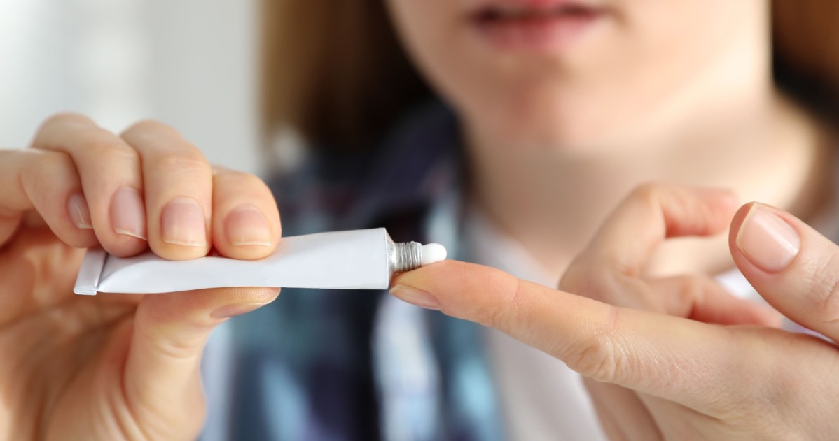 Maść cynkową najlepiej nakładać na skórę punktowo. /123RF/PICSEL