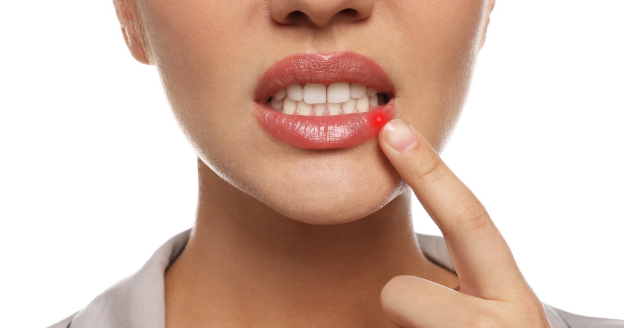 Maść propolisowa nadaje się również do pielęgnacji ust, szczególnie kiedy mamy tendencję do opryszczek. /liudmilachernetska /123RF/PICSEL