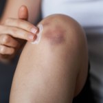 Maść z tej rośliny to zbawienie dla skóry. Przebój z apteki za 5 zł