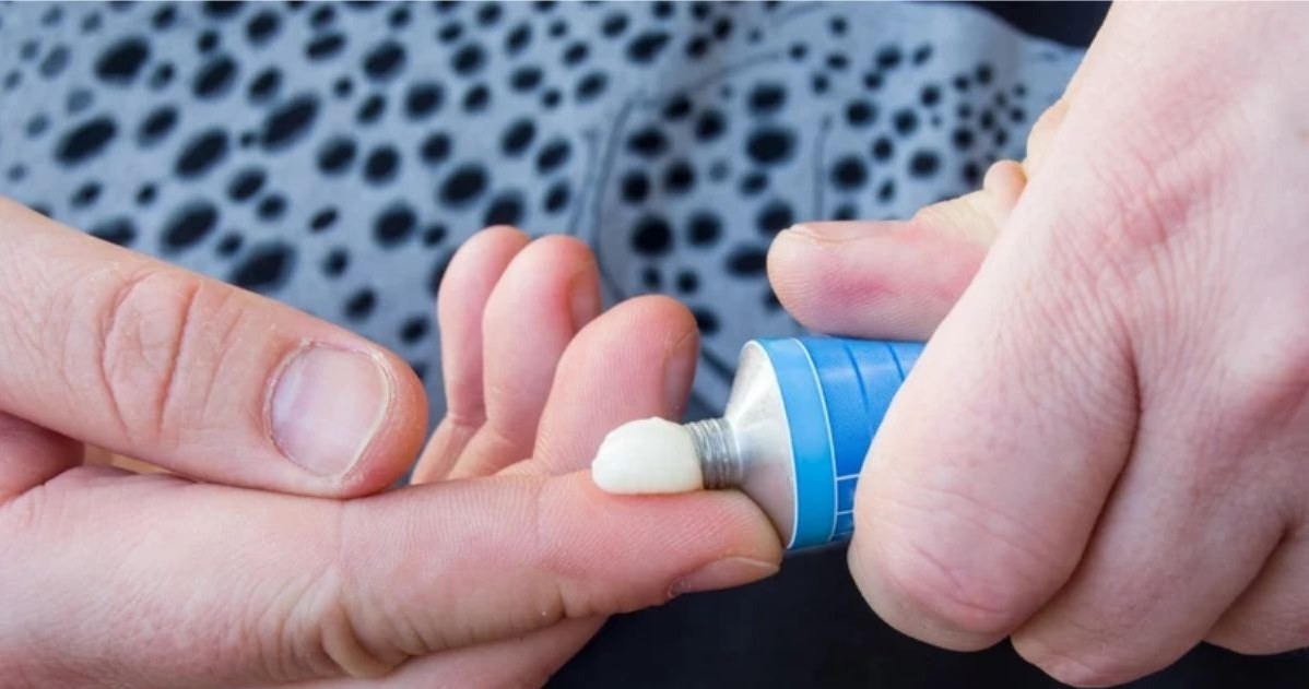 Maść z witaminą A działa świetnie na skórę, odżywiając ją i chroniąc przed niekorzystnymi warunkami /123RF/PICSEL