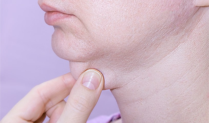 Masz dość "drugiego podbródka"? Tak pozbędziesz się go bez skalpela i drogich zabiegów