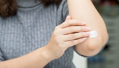 Masz suche i szorstkie jak tarka łokcie? Zamiast drogich balsamów zastosuj to