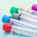 Masz ten wskaźnik podwyższony w badaniu krwi? Organizm wysyła ważny sygnał