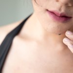 Masz wypukłe znamiona? Kiedy takie "pieprzyki" są OK, a kiedy to powód do zmartwień?