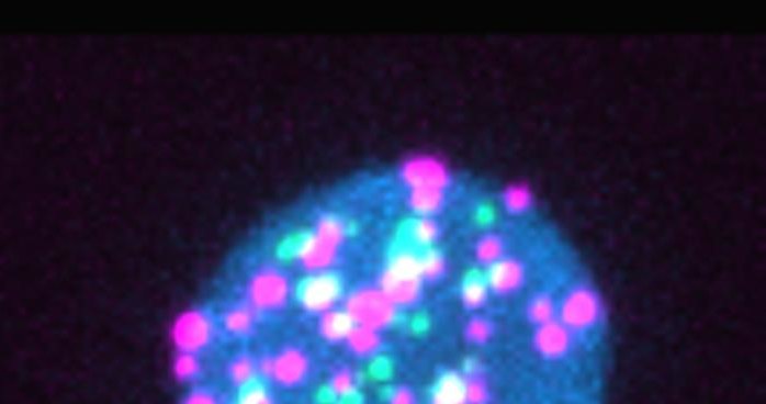 Materiał genetyczny wirusa HIV w postaci zielonych i fioletowych plamek wewnątrz limfocytów T /Aurélie Cleret-Buhot and Mathieu Dubé (both crCRCHUM) /domena publiczna