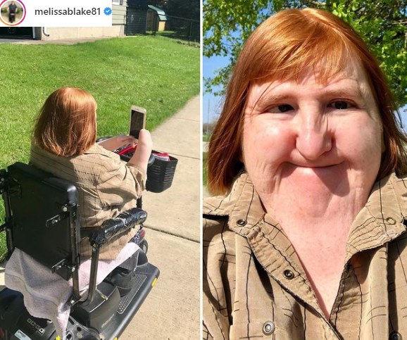 Melissa Blake stara się wspierać osoby niepełnosprawne i wzmacnia ich poczucie własnej wartości /Instagram