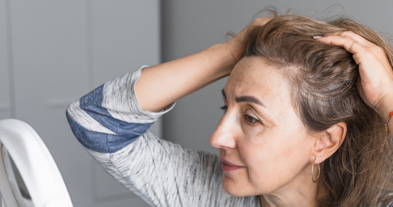 Menopauza – sprawdź, jak skutecznie zregenerować suche i łamliwe włosy! /123RF/PICSEL