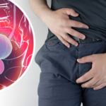Męska dolegliwość uciążliwym problemem. Jak objawia się przerost prostaty?