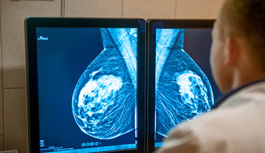 Metody leczenia raka piersi. Nie tylko mastektomia