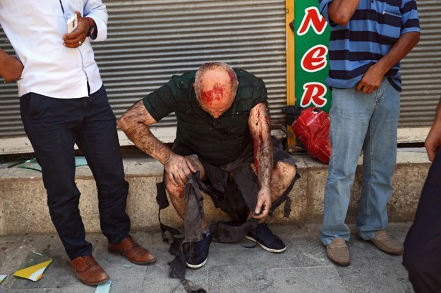 Mężczyzna ranny w eksplozji w mieście Suruc /Depo Photos  /PAP/EPA
