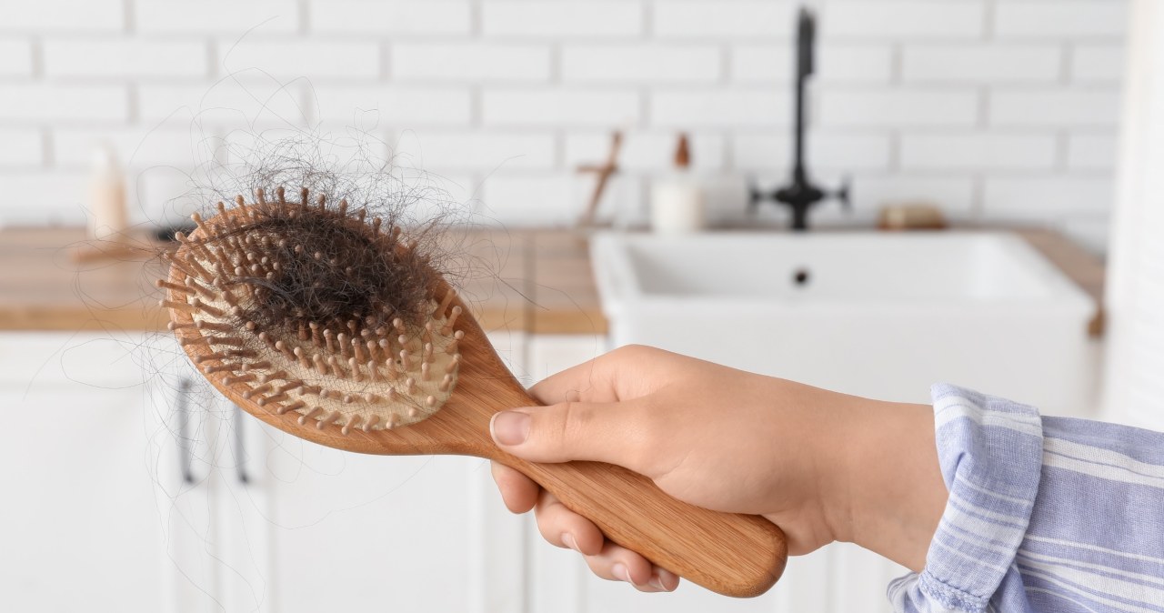 Mezoterapia skóry głowy to ratunek w przypadku wypadających włosów /123RF/PICSEL