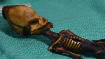 Miał być "obcym", okazał się... ciężko chorą dziewczynką