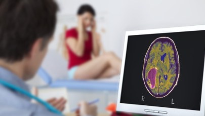 Miała w mózgu żywego robaka. Pierwszy taki przypadek na świecie!