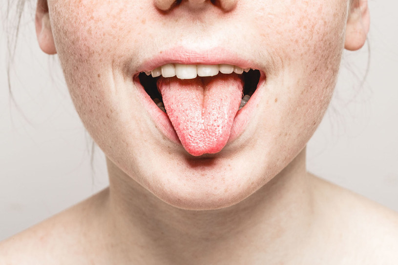 Między stanem naszej jamy ustnej a zdrowiem ogólnym istnieje ścisły związek /123RF/PICSEL