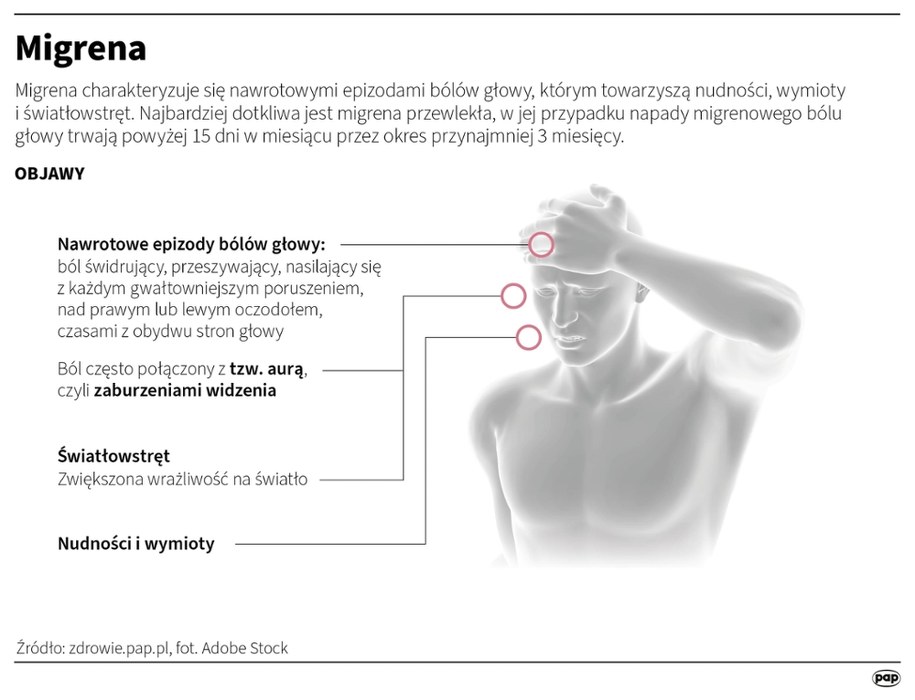 Migrena /Mateusz Krymski /PAP