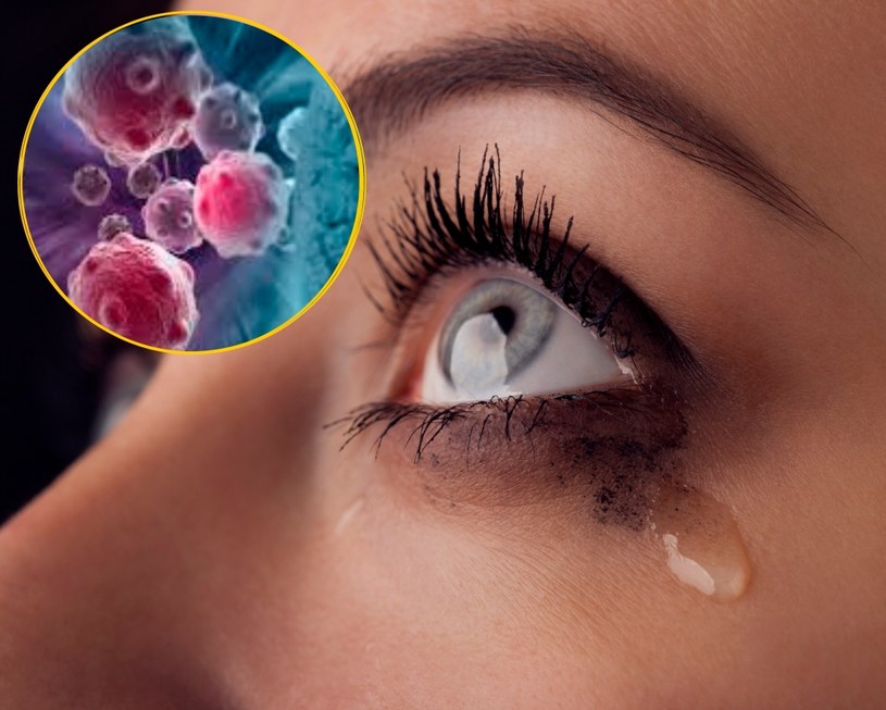Mikrocząsteczki zwane egzosomami we łzach potrafią wykazać, czy ktoś ma cukrzycę /123RF/PICSEL