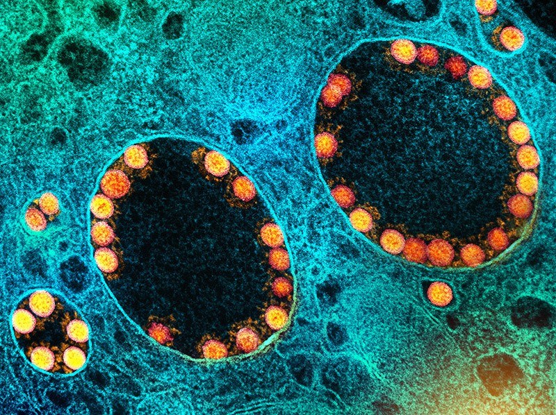 Mikrofotografia SARS-CoV-2 - cząsteczki wirusa widoczne na złoto /materiały prasowe