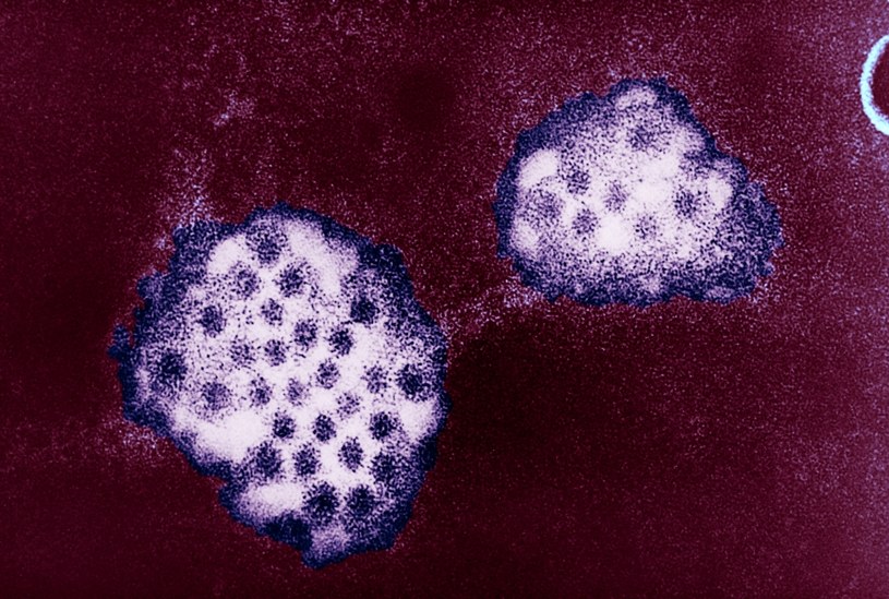 Mikrografia elektronowa wirusa Norwalk należącego do grupy norowirusów. Naukowcy odkryli, że mogą namnażać się także w ślinie. /BSIP/UIG Via Getty Images /Getty Images