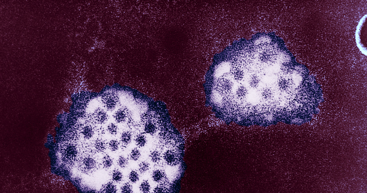 Mikrografia elektronowa wirusa Norwalk należącego do grupy norowirusów. Naukowcy odkryli, że mogą namnażać się także w ślinie. /BSIP/UIG Via Getty Images /Getty Images