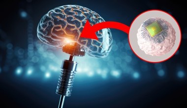 Mikroimplanty zamiast operacji mózgu. Mają leczyć stany zapalne i Alzheimera