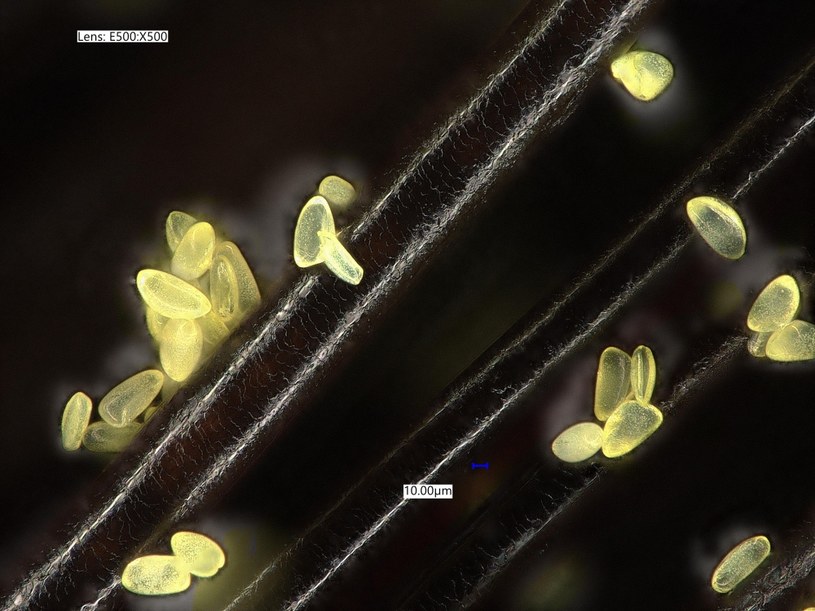 Mikroskopijne pyłki we włosach /materiały prasowe