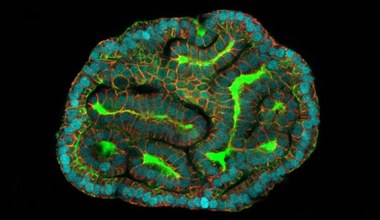 Miniorgany z komórek płodu pobranych od ciężarnych. To przełom!