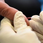 Ministerstwo przestrzega przed "badaniem żywej kropli krwi"