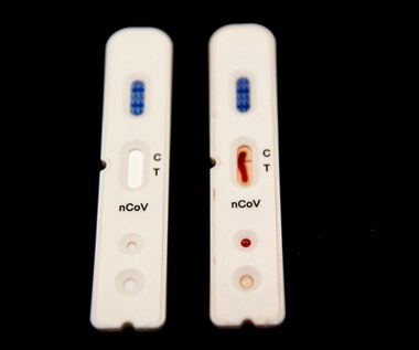Ministerstwo Zdrowia o ścieżce do badania na COVID-19