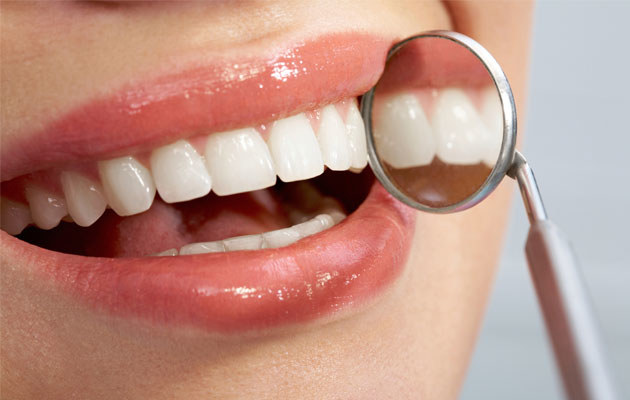 mity na temat wybielania zębów /© Photogenica