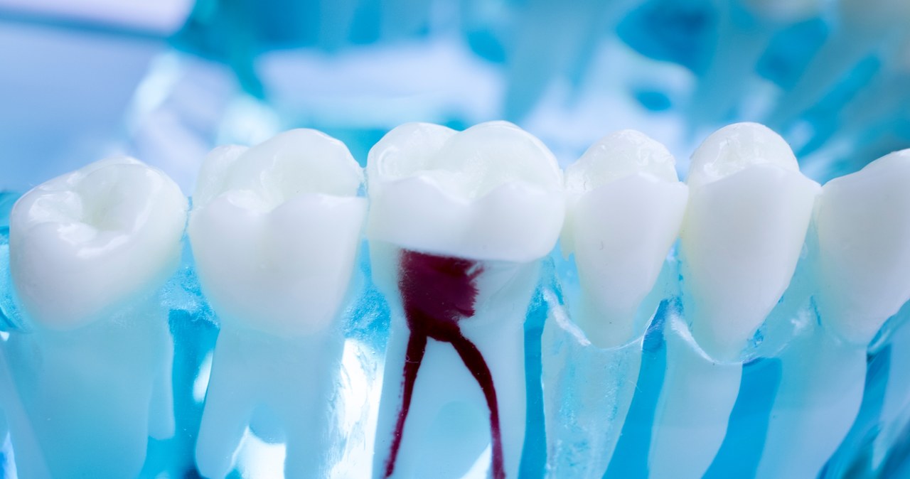 Model zęba, na którym stomatolodzy uczą się, jak leczyć kanały zębowe /123RF/PICSEL