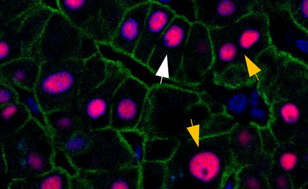 Moja wątroba ma niespełna trzy lata. I twoja też...