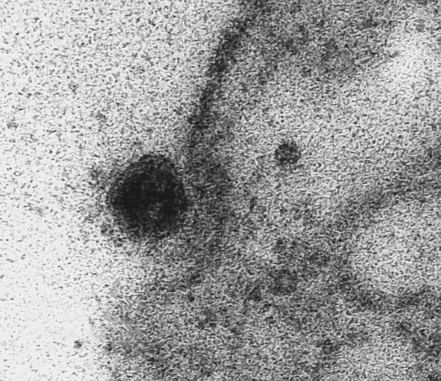 Moment, w którym koronawirus infekuje komórkę /FIOCRUZ HANDOUT /PAP/EPA