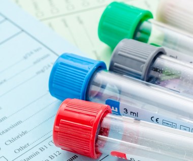 Morfologia: Jak poprawnie czytać wyniki?