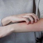 Możesz mieć alergię na wodę. To wciąż wielka zagadka medycyny