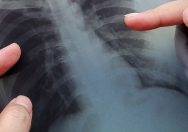 Możesz odetchnąć z ulgą? Zbadaj się!