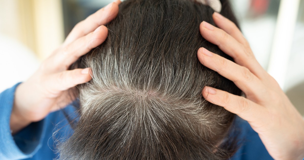 Możesz zapobiec siwieniu włosów. Wystarczy prosty, domowy sposób /123RF/PICSEL