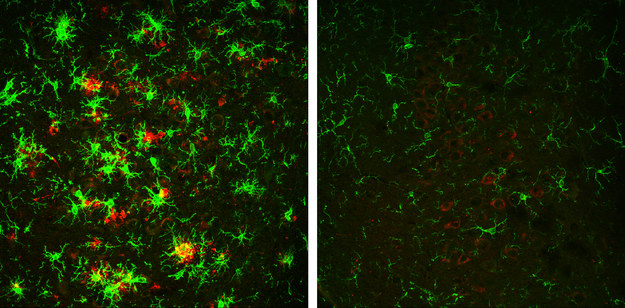 Mózg 10-miesięcznej myszy z chorobą Alzheimera (po lewej). Na czerwono oznaczono złogi białkowe. Po prawej mózg myszy, która stopniowo traci enzym BACE1 /Hu et al., 2018 /Materiały prasowe
