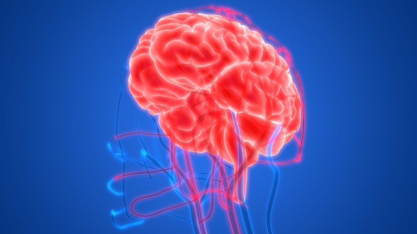 Mózg otrzymuje mniej krwi, jeśli serce jest uszkodzone, co może prowadzić do zmian demencyjnych /123RF/PICSEL