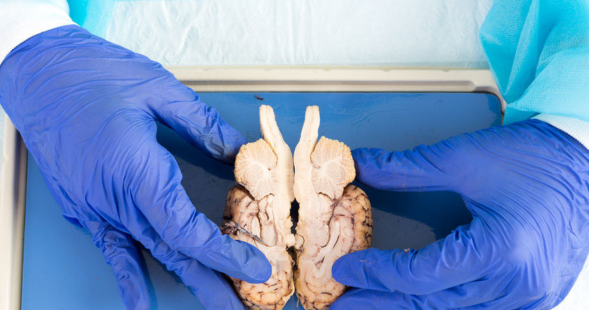 Mózg to najważniejszy narząd człowieka. Do tej pory nie udawało się stworzyć go w laboratorium. /123RF/PICSEL